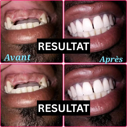 SnaponSmile™ : Révélez Votre Plus Beau Sourire