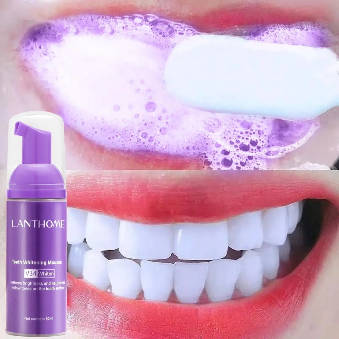 Coffret de blanchiment dentaire 3 en 1 V34 Color