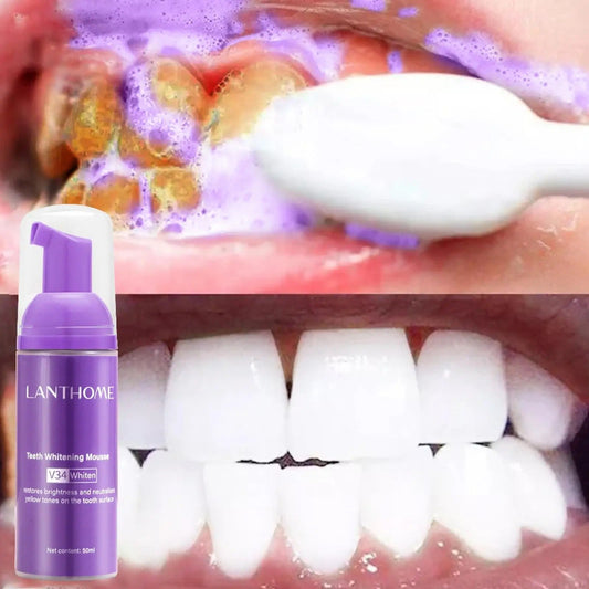 Coffret de blanchiment dentaire 3 en 1 V34 Color